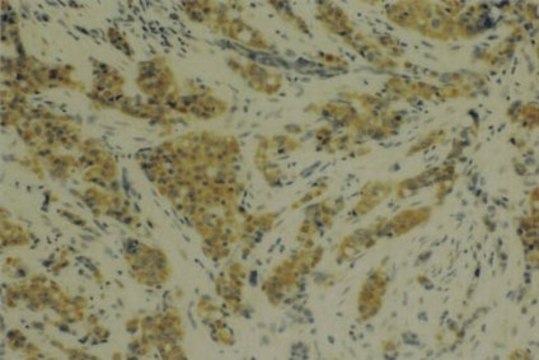 Anti-MMP-14 Antibody, catalytic domain, clone 114-6G6 clone 114-6G6, Chemicon&#174;, from mouse