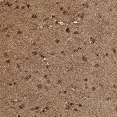 Anti-PHGDH antibody produced in rabbit Prestige Antibodies&#174; Powered by Atlas Antibodies, affinity isolated antibody, buffered aqueous glycerol solution, Ab1
