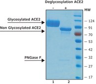 Angiotensin Converting Enzyme-2, ACE2 Human recombinant, ≥1000000 U/mg, expressed in HEK 293 cells