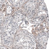 Anti-CHRM3 antibody produced in rabbit Prestige Antibodies&#174; Powered by Atlas Antibodies, affinity isolated antibody, buffered aqueous glycerol solution