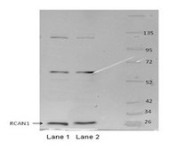 Anti-RCAN1 affinity isolated antibody