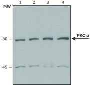 Anti-Protein Kinase&#160;C&#945; antibody produced in rabbit whole antiserum