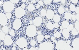 Anti-Neutrophil Elastase Antibody, clone 1B2 ZooMAb&#174; Rabbit Monoclonal recombinant, expressed in HEK 293 cells