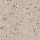 Anti-PSMB2 antibody produced in rabbit Prestige Antibodies&#174; Powered by Atlas Antibodies, affinity isolated antibody, buffered aqueous glycerol solution, Ab1