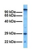 Anti-SLC12A2 antibody produced in rabbit IgG fraction of antiserum