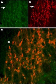Anti-Potassium Channel Kv11.2 (erg2) antibody produced in rabbit affinity isolated antibody, lyophilized powder