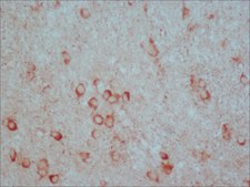 Anti-Beclin 1 (N-terminal) antibody produced in rabbit IgG fraction of antiserum, buffered aqueous solution