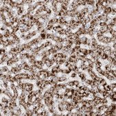 Anti-ABCD3 antibody produced in rabbit Prestige Antibodies&#174; Powered by Atlas Antibodies, affinity isolated antibody, buffered aqueous glycerol solution