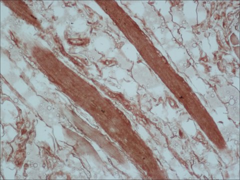Anti-Tropomyosin (Sarcomeric) antibody, Mouse monoclonal clone CH1, purified from hybridoma cell culture
