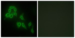 Anti-Collagen V &#945;2 antibody produced in rabbit affinity isolated antibody