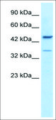 Anti-GATA3 antibody produced in rabbit affinity isolated antibody