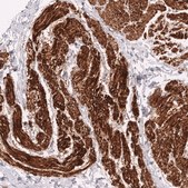 Monoclonal Anti-Myh11 Antibody Produced In Mouse Prestige Antibodies&#174; Powered by Atlas Antibodies, clone CL14619, affinity isolated antibody, buffered aqueous glycerol solution