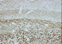 Anti-Neurofilament 160 kDa Antibody, clone NN18 clone NN18, Chemicon&#174;, from mouse