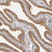Anti-RPGR antibody produced in rabbit Prestige Antibodies&#174; Powered by Atlas Antibodies, affinity isolated antibody, buffered aqueous glycerol solution