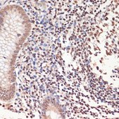 Anti-PARP1 antibody produced in rabbit