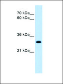 Anti-TAL1 (AB2) antibody produced in rabbit affinity isolated antibody
