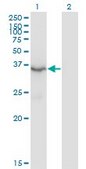 Monoclonal Anti-HSD3B2 antibody produced in mouse clone 1E8, purified immunoglobulin, buffered aqueous solution