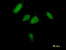 Anti-CCND3 antibody produced in mouse IgG fraction of antiserum, buffered aqueous solution