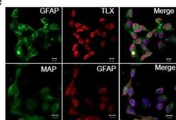 Anti-MAP2 (2a+2b) antibody, Mouse monoclonal ~2&#160;mg/mL, clone AP-20, purified from hybridoma cell culture