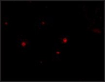 Anti-STIM2 (ab1) antibody produced in rabbit affinity isolated antibody, buffered aqueous solution