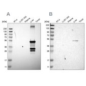 Anti-CYP2C8 antibody produced in rabbit Prestige Antibodies&#174; Powered by Atlas Antibodies, affinity isolated antibody, buffered aqueous glycerol solution