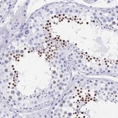 Anti-HDGFL1 antibody produced in rabbit Prestige Antibodies&#174; Powered by Atlas Antibodies, affinity isolated antibody, buffered aqueous glycerol solution