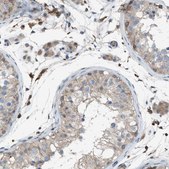 Anti-DYRK1A antibody produced in rabbit Prestige Antibodies&#174; Powered by Atlas Antibodies, affinity isolated antibody, buffered aqueous glycerol solution