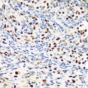 Anti-PBRM1 antibody produced in rabbit