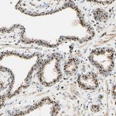 Anti-GOLGB1 antibody produced in rabbit Ab2, Prestige Antibodies&#174; Powered by Atlas Antibodies, affinity isolated antibody, buffered aqueous glycerol solution