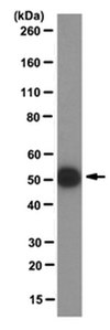 Anti-PP2A reg. subunit B56 epsilon (PPP2R5E) Antibody, clone 5A5-1F3 clone 5A5-1F3, from mouse