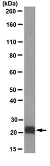 Anti-Pan-Ras Antibody, clone RAS 10 clone RAS 10, from mouse
